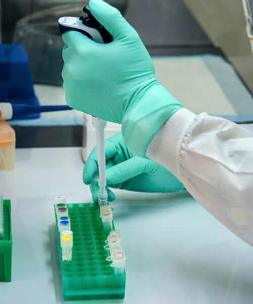 Person mit grünen Schutzhandschuhen pipettiert Flüssigkeit in kleine Probengefäße in einem Labor.