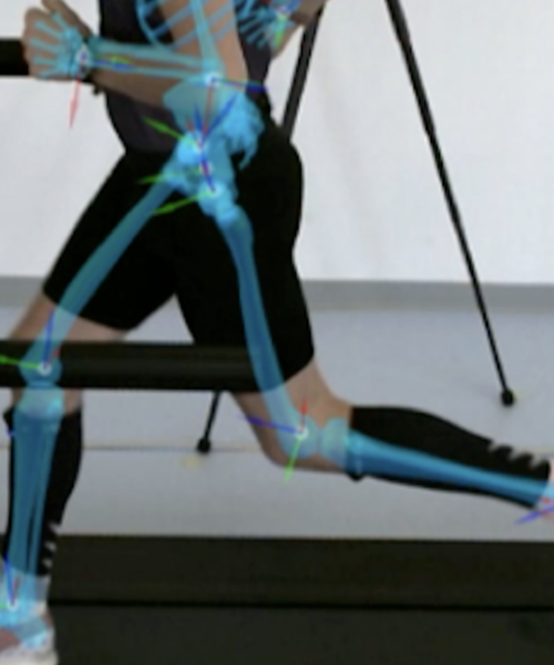 Ausschnitt einer Laufanalyse mit digital eingeblendeten Skelettstrukturen während des Laufens auf einem Laufband.