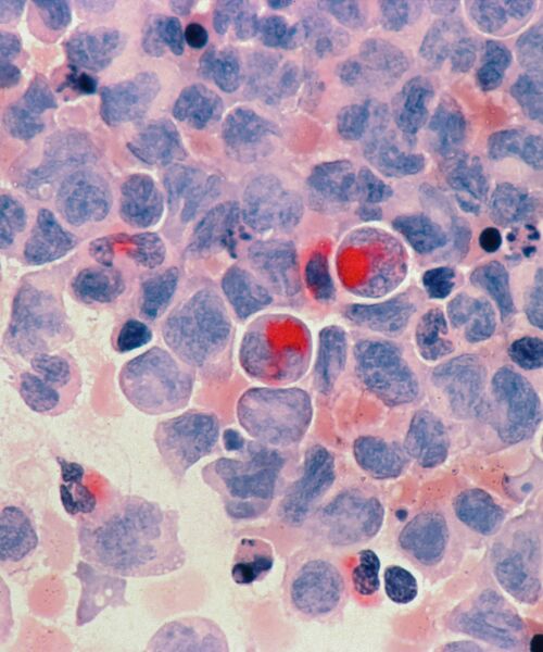 Mikroskopische Aufnahme von gefärbten Zellen in Blau- und Rottönen, vermutlich Gewebe- oder Blutzellen.