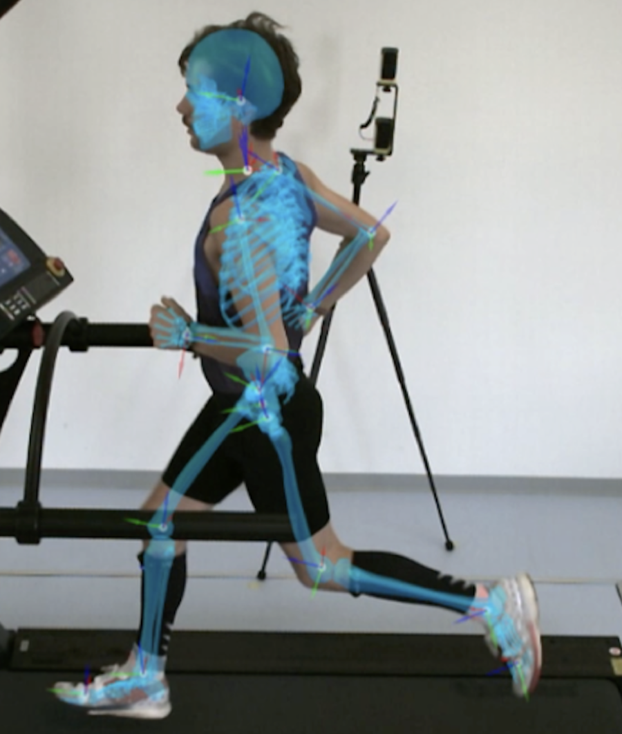 Person läuft auf einem Laufband, überlagert von einer digitalen Darstellung des Skeletts zur Bewegungsanalyse.